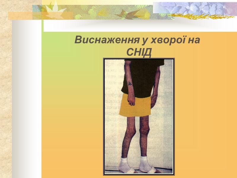 Виснаження у хворої на  СНІД